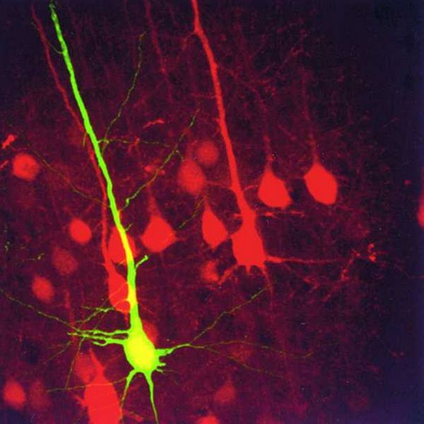 Piros és zöld FP-t kifejező agykérgi serekntő sejtek.