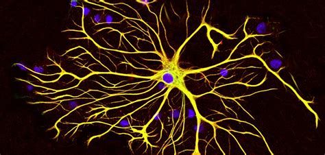 Asztrogliasejt fluoreszcens mikroszkópban készített fényképe. A kék foltok idegsejtek és más gliasejtek magjait mutatják. A sej nyúlványrendszere sárga.